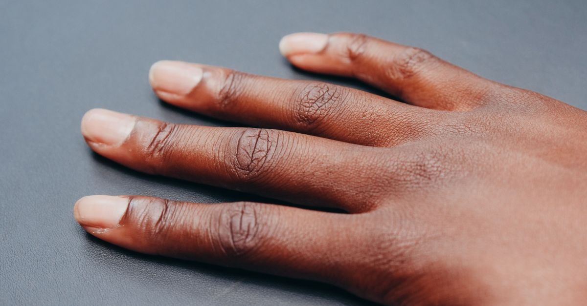 Ongles striés : 7 solutions simples pour retrouver des ongles lisses et forts