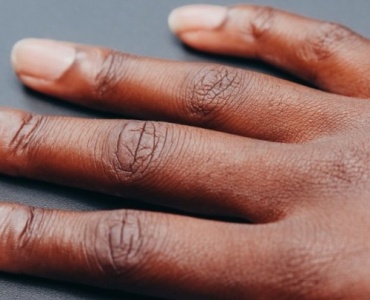 Ongles striés : 7 solutions simples pour retrouver des ongles lisses et forts