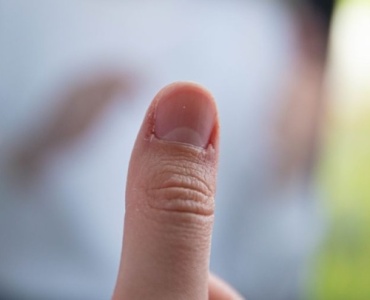 Adieu aux ongles fragiles : comprendre et stopper le dédoublement pour des mains impeccables